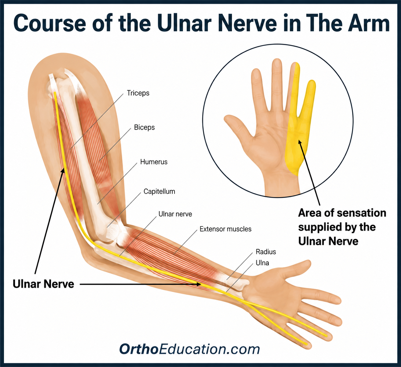 Ulnar Palsy Overview